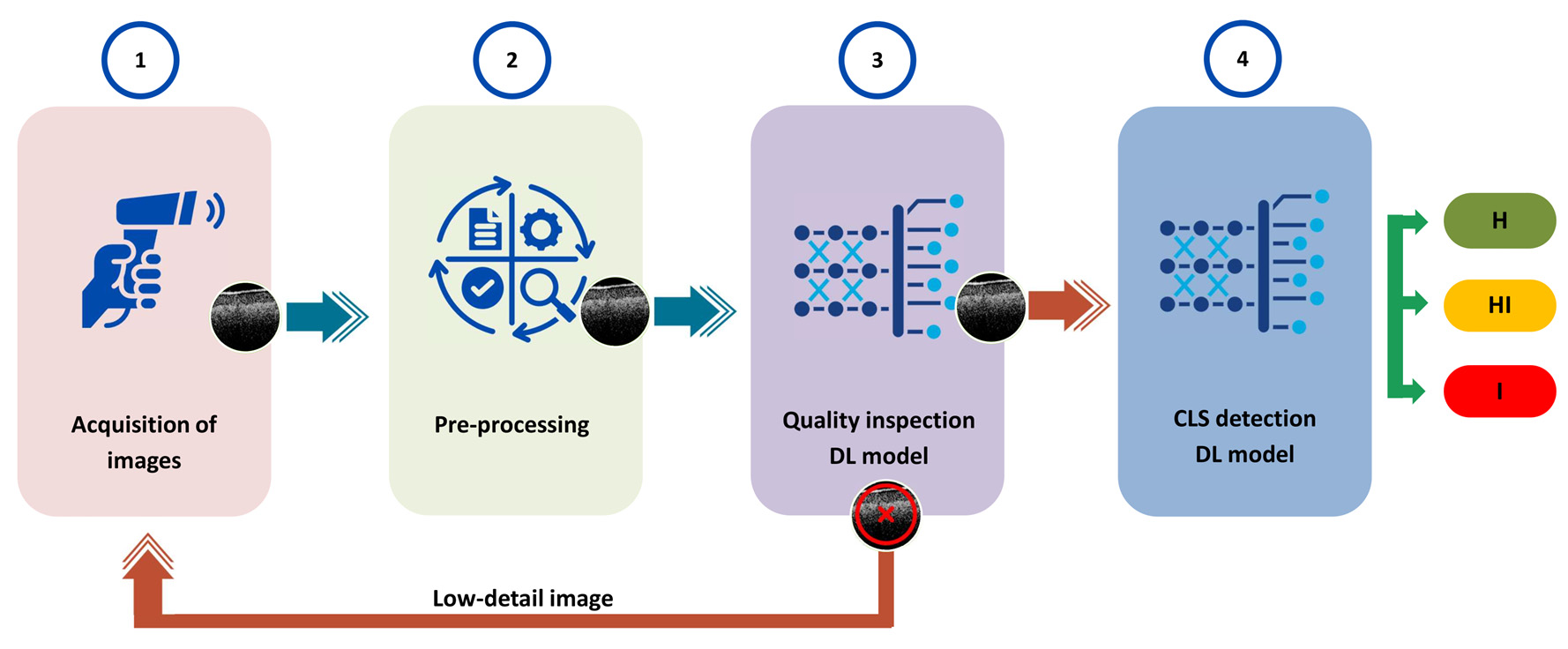 Pipeline from OCT acquisition and preprocessing to image-quality screening and disease-stage classification.