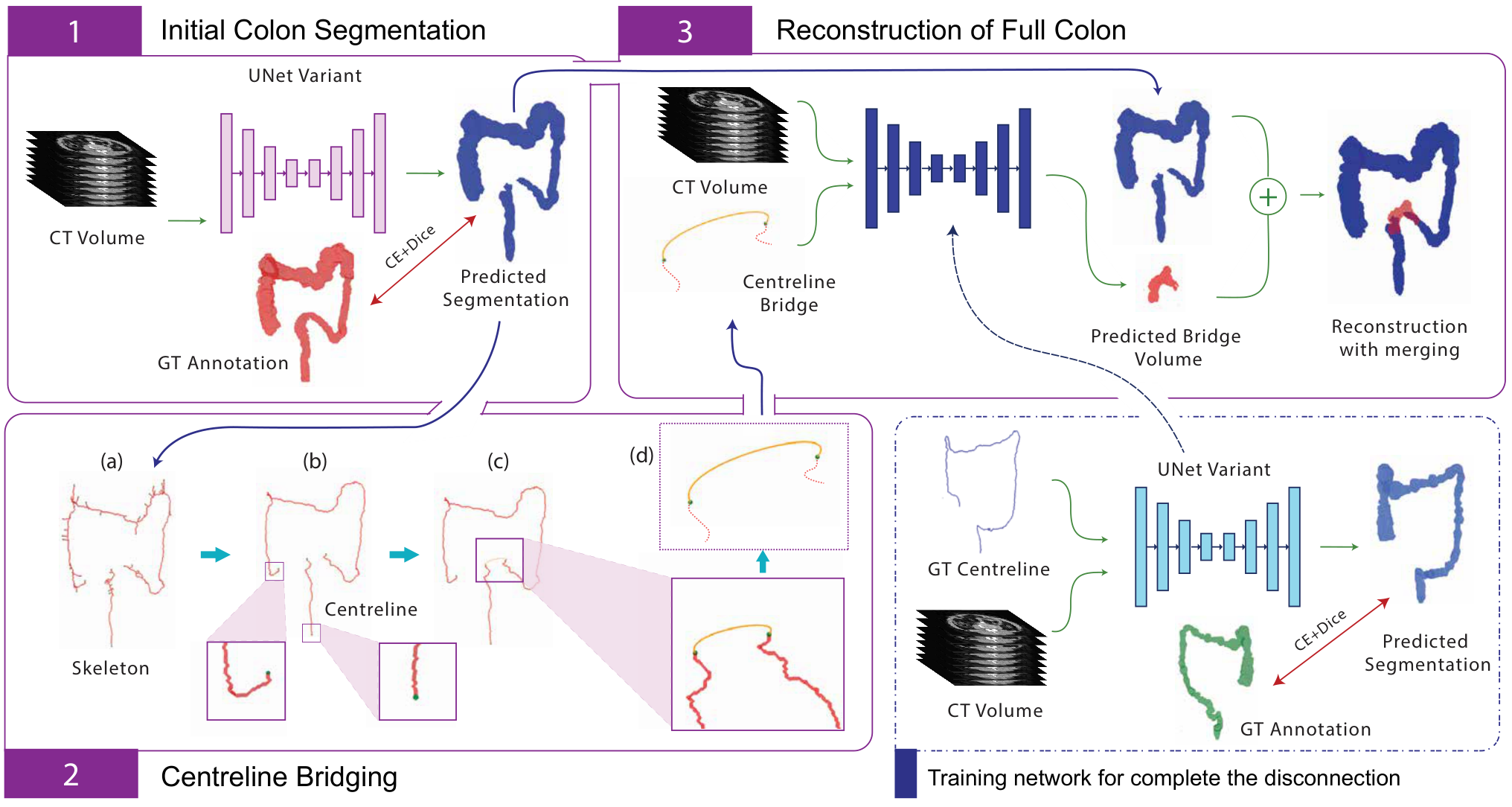 Three stages: initial colon segmentation, centreline bridging, and reconstruction of missing regions.